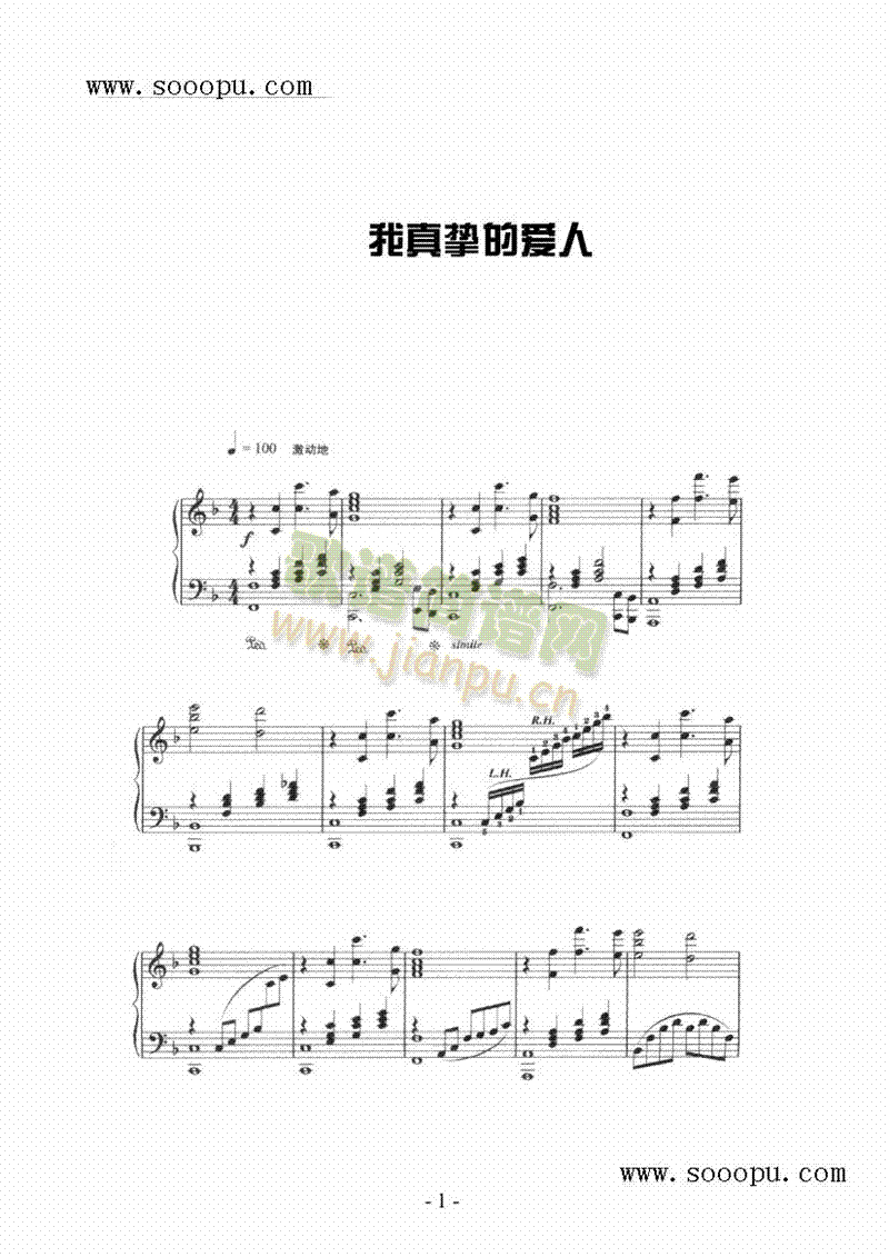 擴ĐIP(V)1