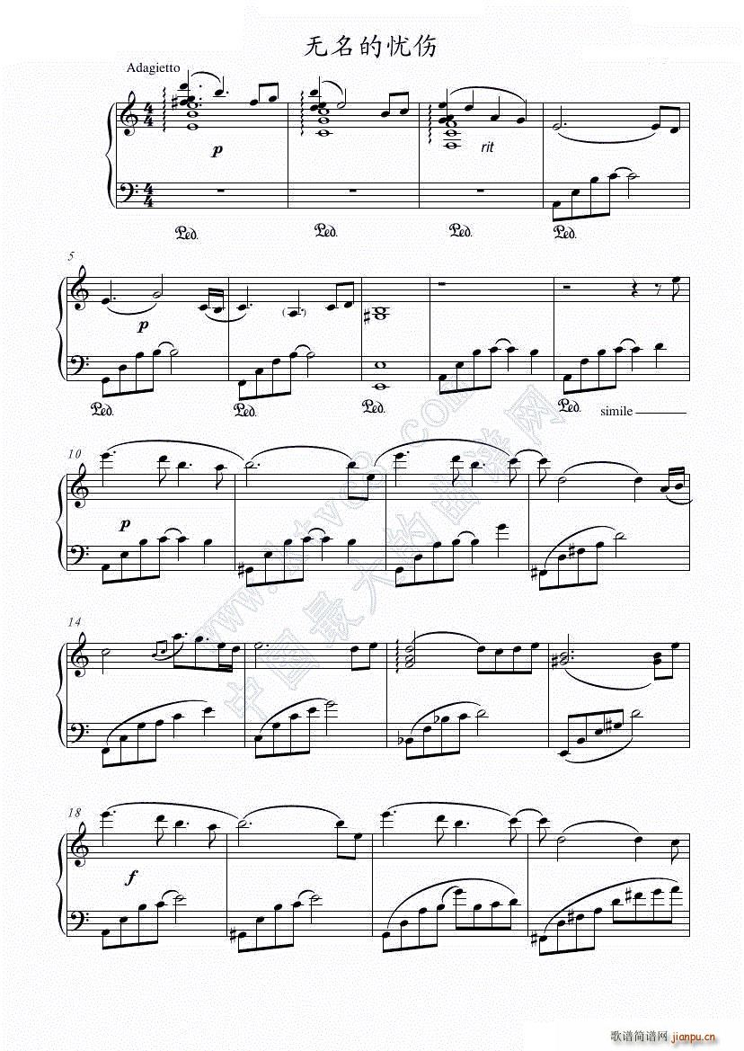 ođn(V)1