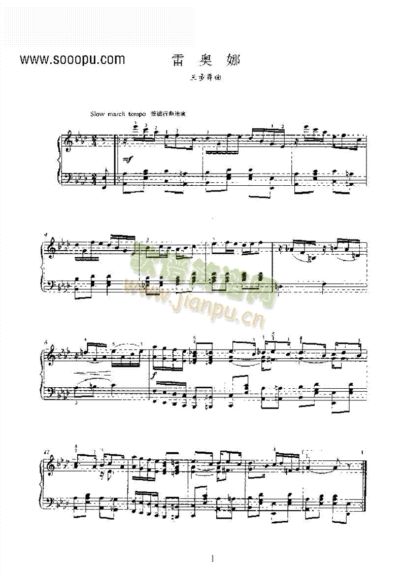 ׊WIP(V)1